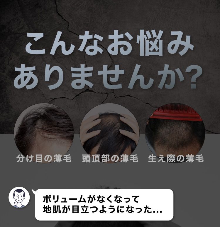 公式】ハゲ隠し・薄毛隠しスプレーはCAX(カックス)。わずか5秒の
