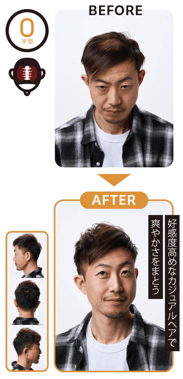 O字型