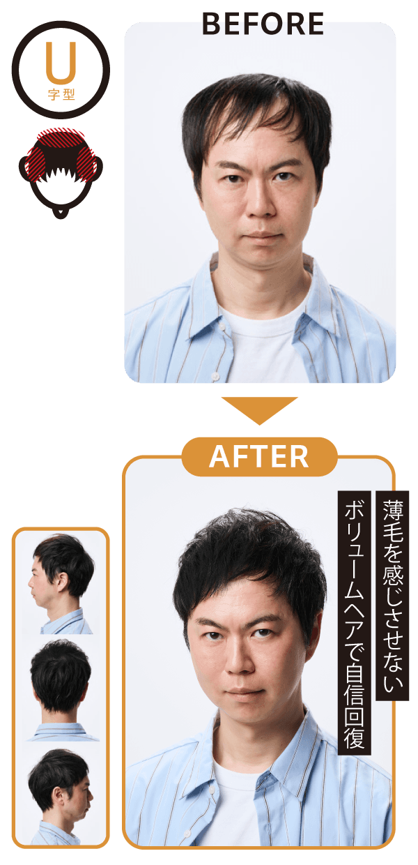 U字型