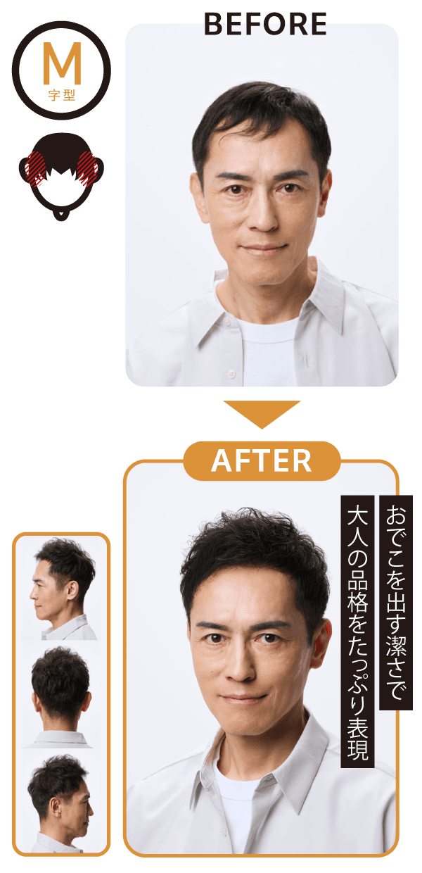 M字型