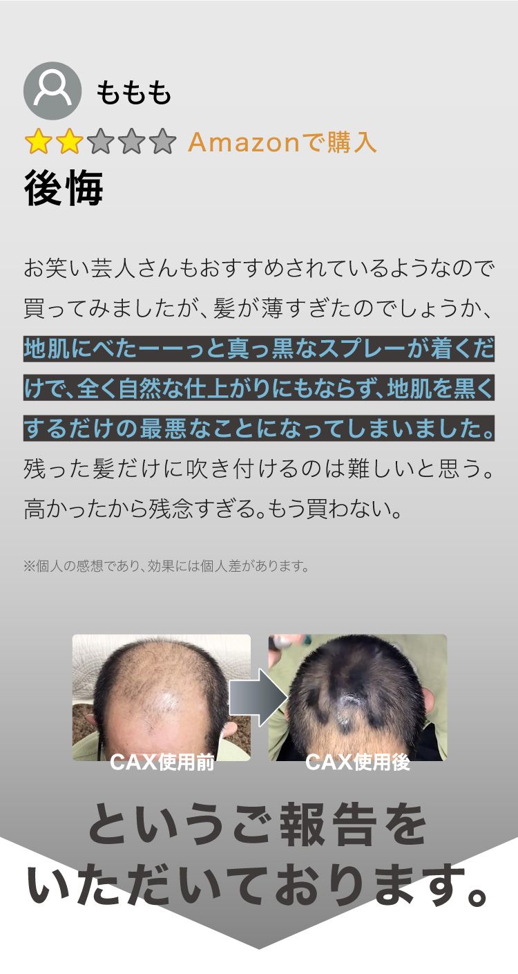CAX カックス 薄毛隠し用 ヘアスプレー 100gブラック5本セット 楽天市場】薄毛隠し 増毛スプレー CAX ボリュームアップスプレー