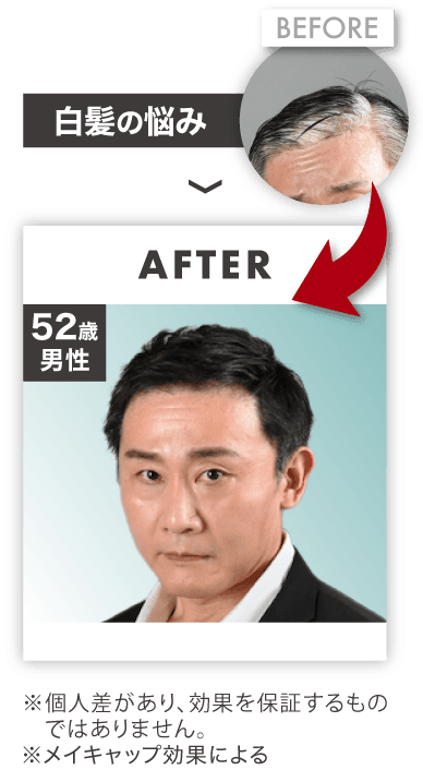 白髪の悩み