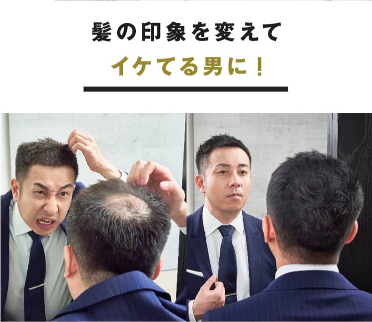 薄毛隠しスプレーCAX(カックス)公式販売ページ