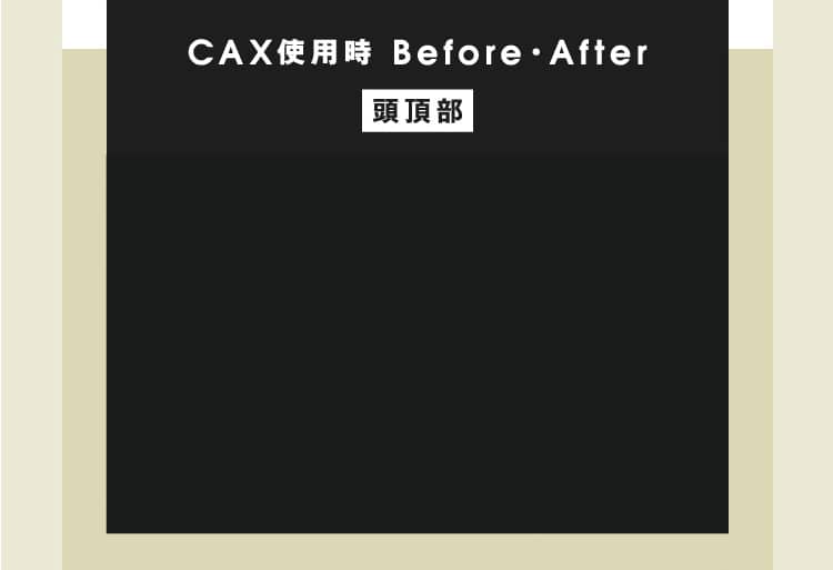 CAX使用時BEFORE・AFTER頭頂部