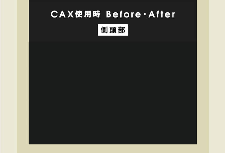 CAX使用時BEFORE・AFTER側頭部