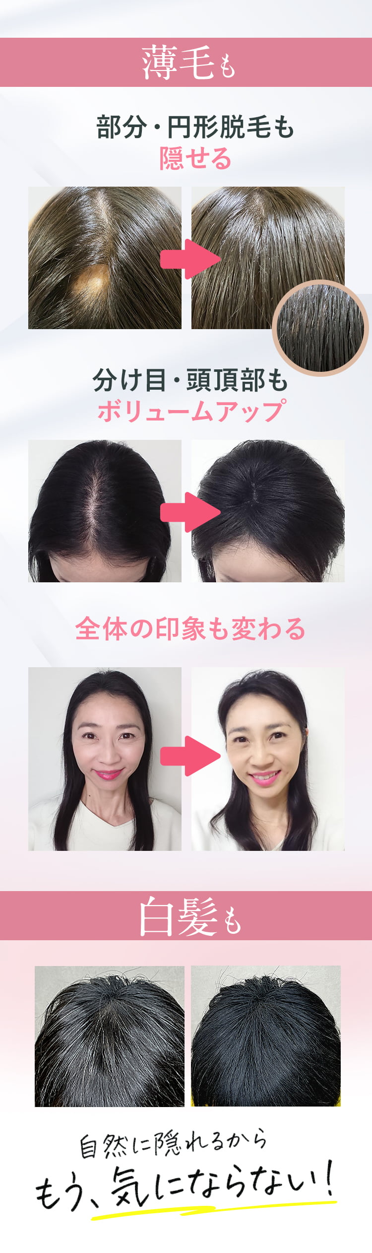 薄毛も部分円形脱毛も・白髪も自然に隠せる
